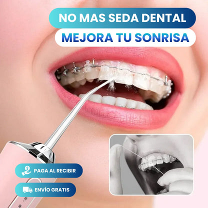 DentaSmile™ - IRRIGADOR BUCAL RECARGABLE