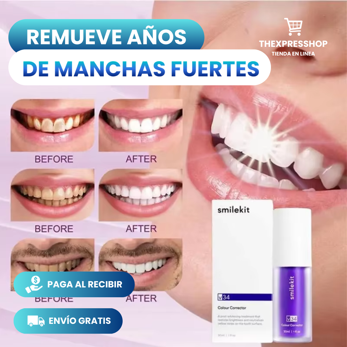 SmileKit® Blanqueador Dental - COMBO 3X1 : ¡Blanquea tus Dientes en 30 SEGUNDOS! 💜✨