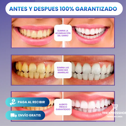 SmileKit® Blanqueador Dental - COMBO 3X1 : ¡Blanquea tus Dientes en 30 SEGUNDOS! 💜✨