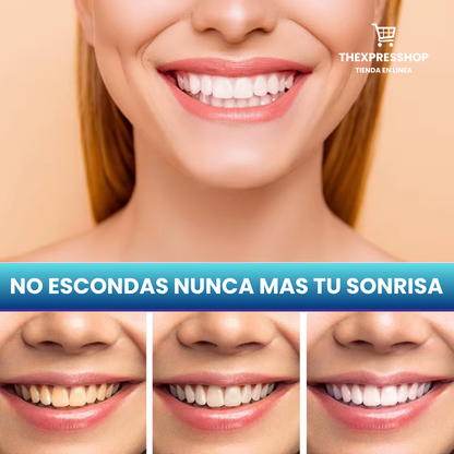 SmileKit® Blanqueador Dental - COMBO 3X1 : ¡Blanquea tus Dientes en 30 SEGUNDOS! 💜✨