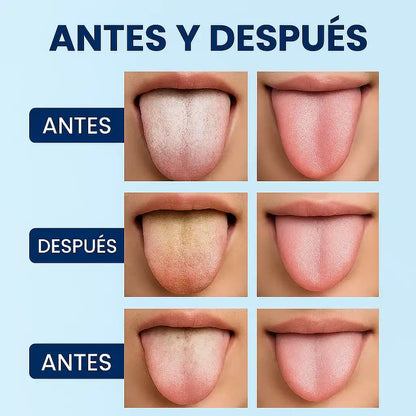 Gel limpiador de lengua + cepillo fresco